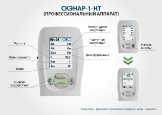 СКЭНАР-1-НТ (исполнение 01)  в Вольске купить Медицинская техника - denasosteo.ru 